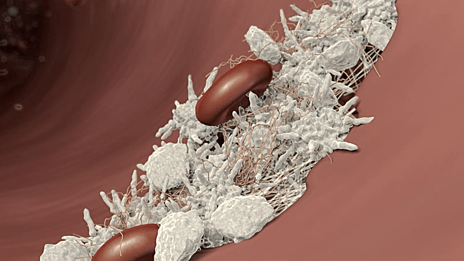 Image of red blood cells and fibrinogen building in a tear